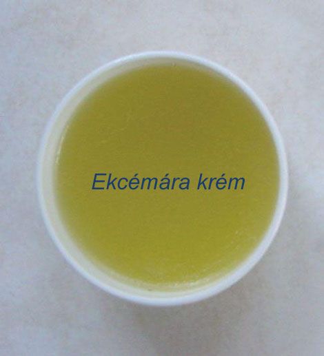 ekcéma